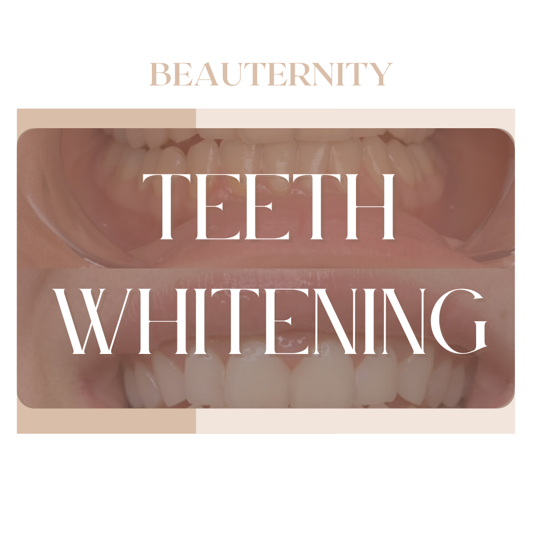 Cosmetic Teeth Whitening